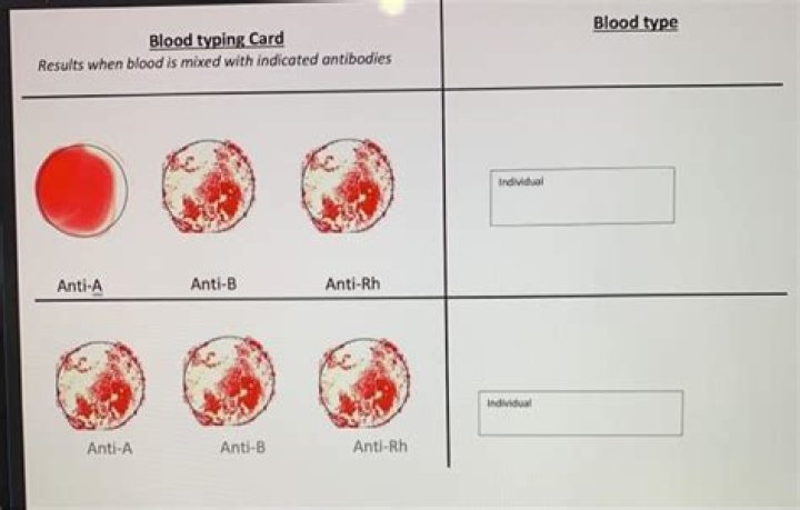 Blood Typing Card Results Quiz