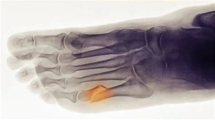 Words Created Using the Letters in 'fract'