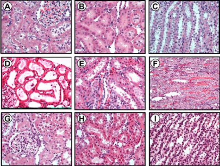 Histology of Renal Medulla Quiz