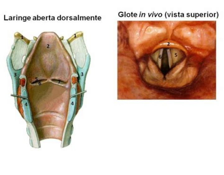 Laringe aberta dorsalmente Quiz