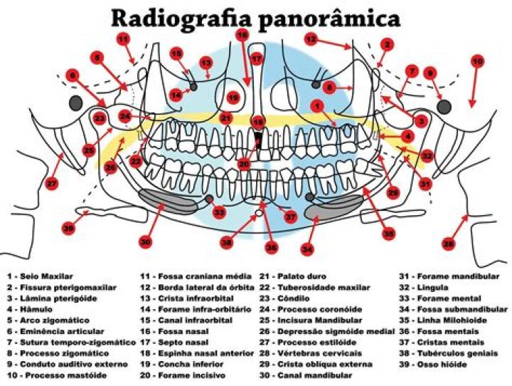 Radiografia Panorâmica - Estruturas Anatômicas Quiz