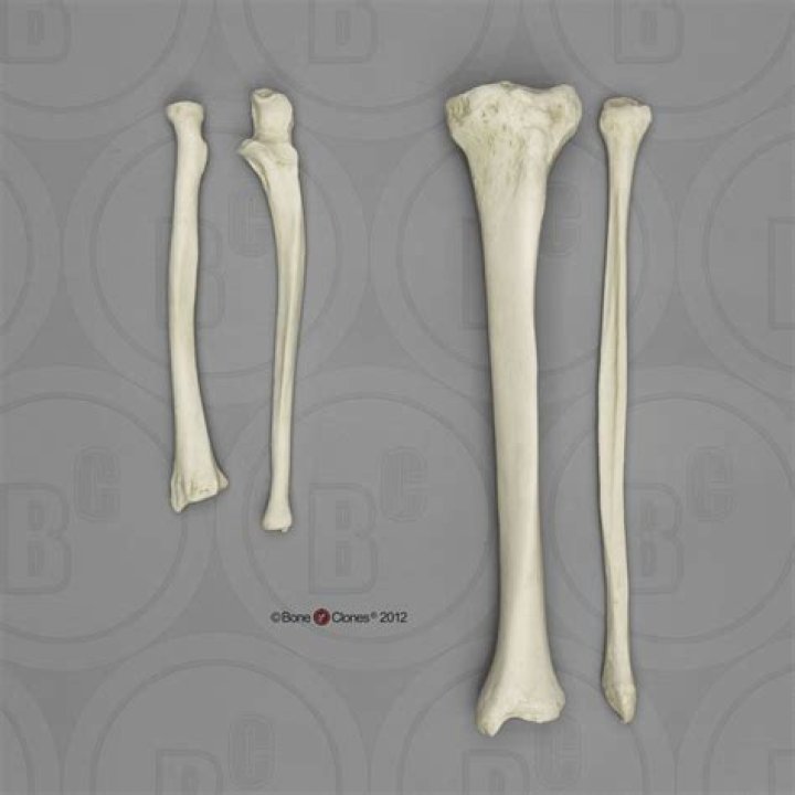 Radius, Ulna, Tibia, Fibula Quiz